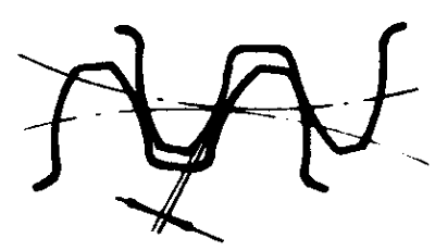 �F�X݆�͜��p�����X݆�g(sh��)�Z�����ߴ煢��(sh��)